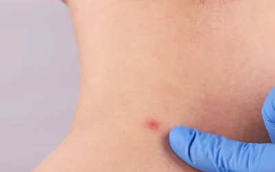 Campaña dermatológica